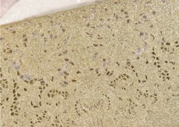 elegante Hochzeitskarte, edler Lasercut im Goldrausch, Hochzeitspapeterie Gold